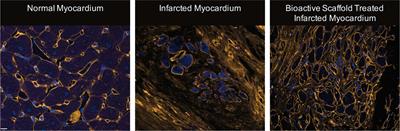 Using Acellular Bioactive Extracellular Matrix Scaffolds to Enhance Endogenous Cardiac Repair